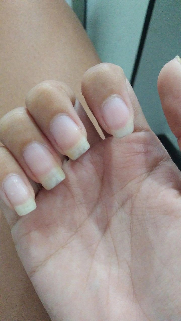 After image
